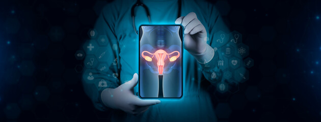 Image of a T-shaped contraceptive intrauterine device inside the uterus. The doctor studies and...