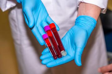 Doctor showing tubes of blood samples in a donation center