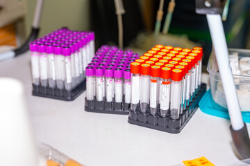 Samples of blood labeled on a table
