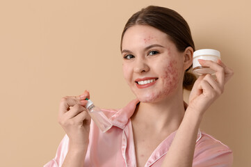 Young woman with acne problem and skincare products on beige background, closeup