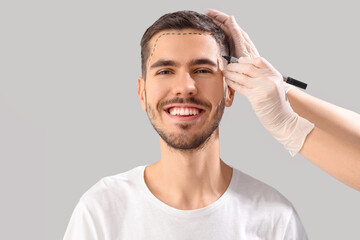 Doctor marking young man's forehead with hair loss problem on light background, closeup