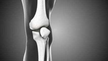 Gap and discomfort in the knee joints