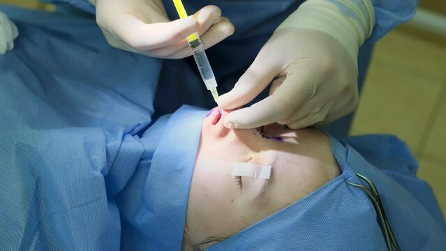 Local anesthesia of the nose with a styrene syringe to a girl patient. Endoscopic septoplasty surgery.