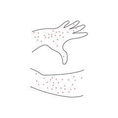 Skin rash line icon vector. Vector illustration allergy, scabies, chicken pox, rubella rash.