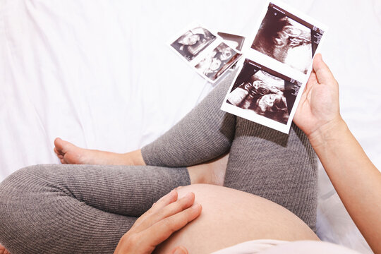 Close-up of a pregnant woman holding an ultrasound scan. Pregnant woman holding ultrasound image.