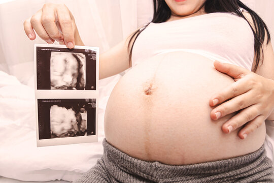 Close-up of a beautiful pregnant woman holding an ultrasound scan. A pregnant Asian woman is smiling holding an ultrasound image.