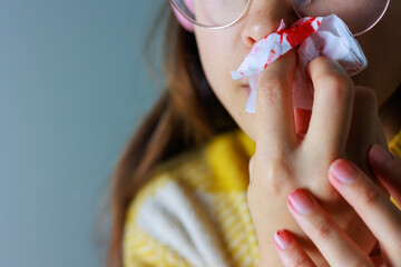 鼻血をティッシュ拭う女性