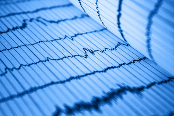 Sinus Heart Rhythm On Electrocardiogram Record Paper Showing Normal P Wave, PR and QT Interval and...