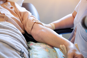 Closeup hands of physical therapist using electrical muscle stimulation (EMS) at arm elderly...