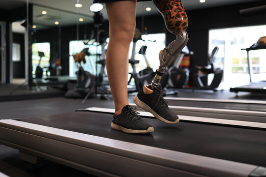 Low angle view at woman with prosthetic leg walking in treadmill at fitness gym