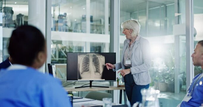Surgeon, lungs xray or woman teaching in hospital for planning, meeting or healthcare presentation. Hand up, screen or sales representative asking medical people for medicine questions or feedback