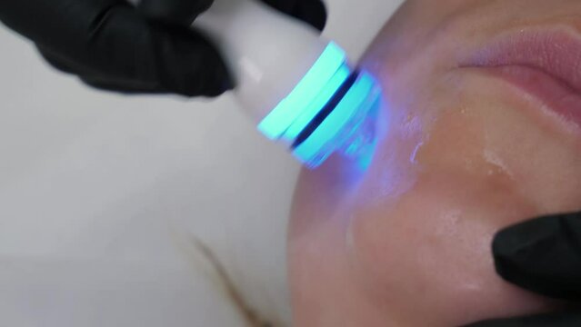 Polishing cheek skin and Vacuum cleaning of unrecognizable woman in cosmetology clinic. Professional moisturizing and rejuvenating hardware procedures. Non surgery cosmetology skincare, close up