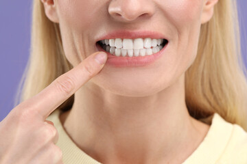 Woman showing her clean teeth on violet background, closeup view