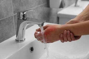 Woman holding burned hand under cold water indoors, closeup