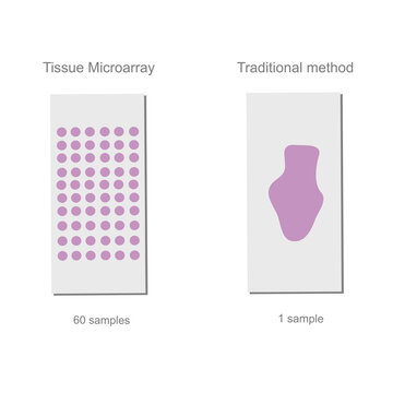 The technique comparison between Traditional method and Tissue microarray (TMA) for target detection in pathology principle.