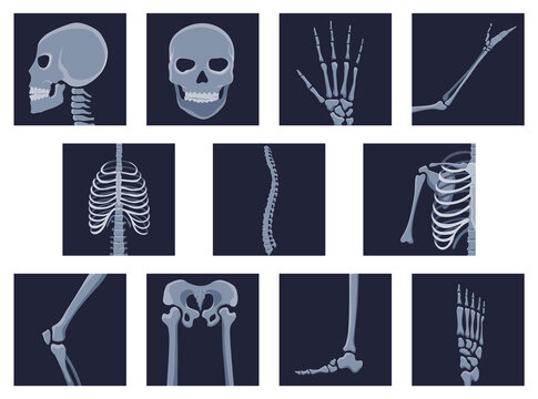 Human bones orthopedic and skeleton icon set, bone x-ray image of human joints, anatomy skeleton flat design illustration