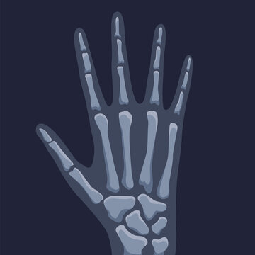 Human bones orthopedic and skeleton icon, bone x-ray image of human joints, anatomy skeleton flat design illustration