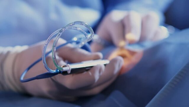 An ophthalmic surgery specialist performs an operation. Close-up. A male doctor performs a high-precision operation. Femtolaser cataract surgery.
