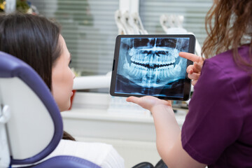 Dentist presents the patient with an X-ray and engages in a discussion about treatment options