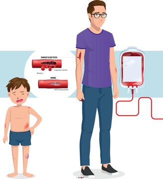 Hemofilia: uma doen&ccedil;a gen&eacute;tica que afeta a coagula&ccedil;&atilde;o do sangue