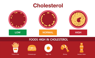 Naklejka premium Cholesterol in artery, health risk , vector design, foods high in cholesterol