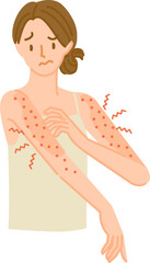 アレルギー反応で腕の皮膚が肌荒れで炎症してかゆい女性