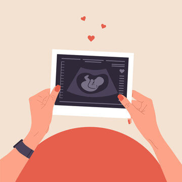 Ultrasound of baby. Female hands holding fetus silhouette photo. Embryo in womb. Pregnancy belly top view. Baby health diagnostic. Sonography or ultrasonography concept. Cartoon vector illustration.
