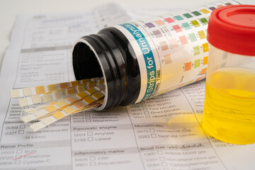 Urinalysis, urine cup with reagent strip pH paper test and comparison chart in laboratory.