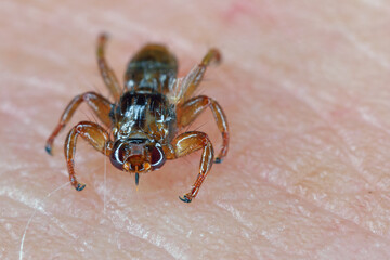 A macro close-up of parasite Deer fly, Lipoptena cervi, on a hairy sking. It is sometimes called...