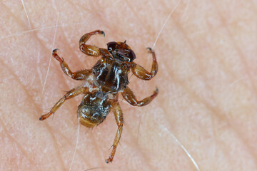A macro close-up of parasite Deer fly, Lipoptena cervi, on a hairy sking. It is sometimes called the flying tick.