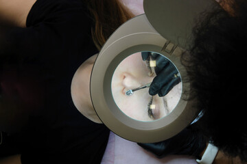 Cosmetologist Performing Facial Cleansing Procedure. A cosmetologist during a facial cleansing session using special equipment to treat the client's skin, view through a magnifying lamp. 