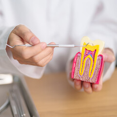 Dentist with tooth Anatomy model. Oral Teeth decay and disease, Scrape off tartar. March Oral health, Dentist Day, False Teeth. Toothache and Children Dental Health Month and Orthodontic Health Day