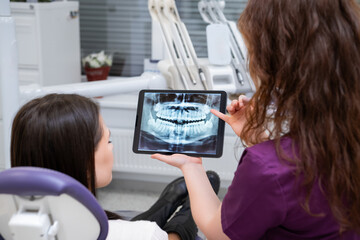Showing the patient the X-ray, the female dentist explains the treatment concept during the...