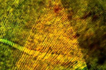 Cellular patterns in moss leaves, made with a polarizing microscope.