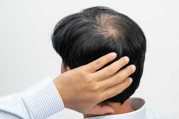 Bald in the middle head and begin no loss hair glabrous of mature Asian business smart active...