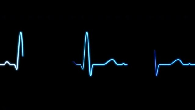Cardiogram EKG ECG signal. Heart beat wave, pulse rhythm