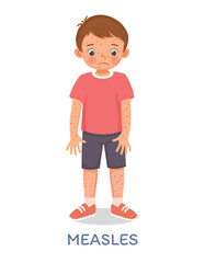 Cute little boy suffering from measles rash allergy skin 