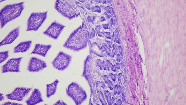 Colon. Digestive system under the microscope in detail. Proctology. Cytologic analysis of colon biopsies. Determination of colon cancer. 100x times magnification