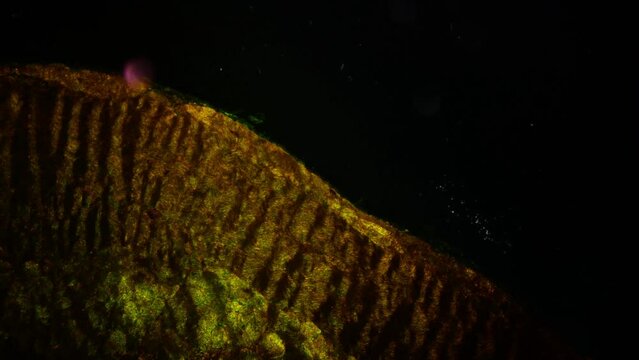Microanatomy. Stratified squamous epithelium. 100x times magnification. Non-keratinized stratified epithelium, nucleuses, rest of the epithelial layer, underlying connective tissue and other epithelia