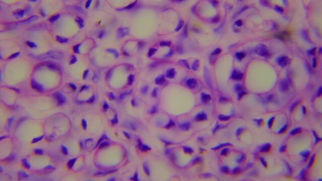 The human kidney. Microanatomy. Cross section of kidney. 1000x magnification. Homeostasis of extracellular fluid. Blood filtration. Metabolism of the vertebrate excretory system