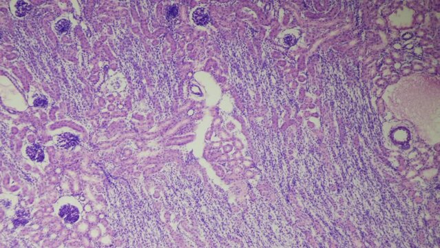 The human kidney. Microanatomy. Transverse section of a mammalian kidney. 100x magnification. Balance of water and electrolytes