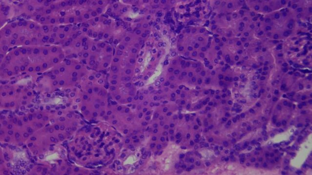 Vital organ. Kidney under the microscope, longitudinal section. Histologic and cytologic examination. Blood purification, regulation of chemical homeostasis. 400x magnification