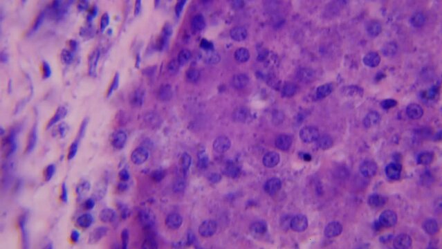 Liver. Under the microscope. 100x magnification. Vitamin metabolism and neutralization. Concept of human organ regeneration. Immortality