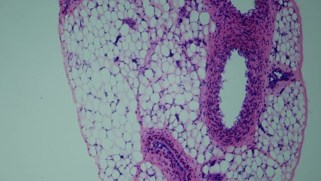 Angiology Lab. Examination of the cross section of vessels. Veins and arteries under the microscope. Magnification of 100 times