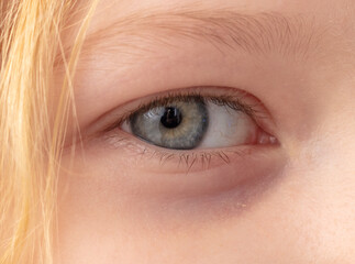 Close-up of a little girl's eyes. Macro