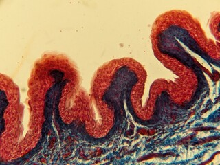 photo of suction of human bladder under the microscope