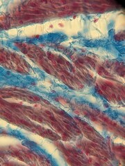 photo of suction of human bladder under the microscope