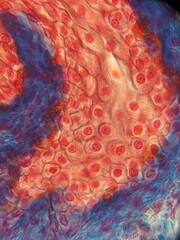 photo of suction of human bladder under the microscope - obrazy, fototapety, plakaty
