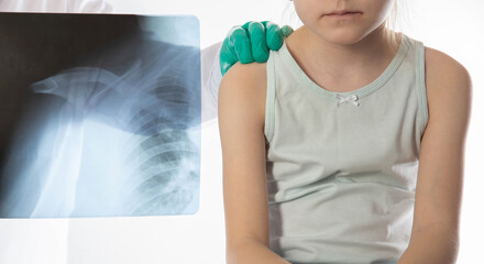 X-ray image of a doctor wearing green medical gloves against the background of a girl patient who...