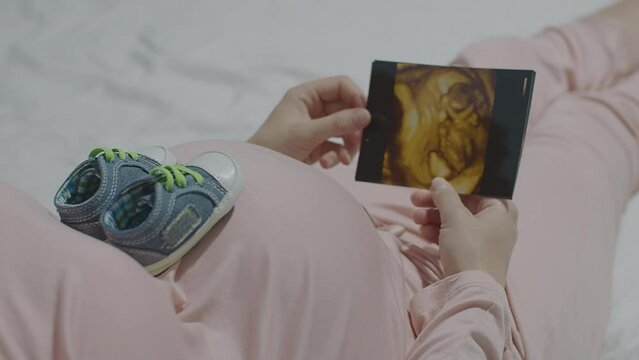 Pregnant woman Expectant mother hold ultrasound photo, baby shoes on belly symbolize anticipation of child arrival. Moment of joy and prepare for new life, emotional journey of maternity, parenthood.